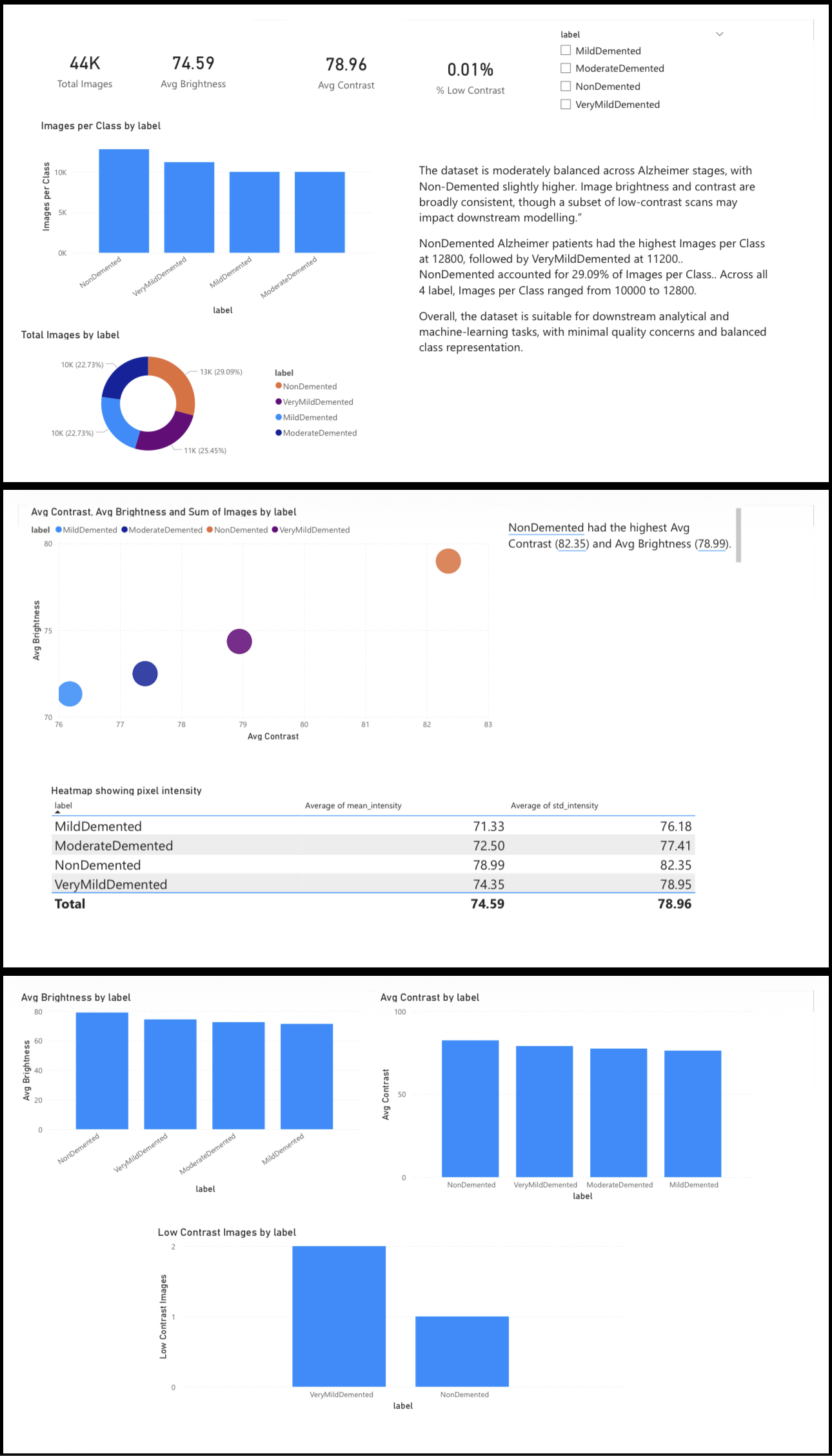 Alzheimer analysis chart preview